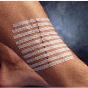 Wound Care