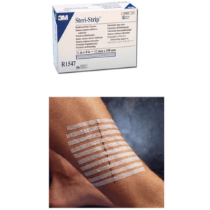 Steristrip Skin Closure